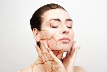 Dry skin