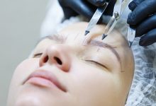 cost of eyebrow transplant