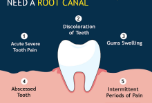 root canal specialist Toronto