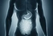 Upper Endoscopy