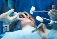Tips to Evaluate Plastic Surgeon