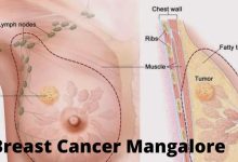 Breast Cancer Mangalore