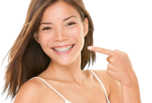Dental Crown