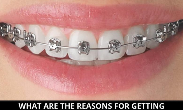 What Are the Reasons for Getting Orthodontic Treatment_