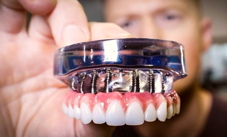 full mouth reconstruction clinic kolkata