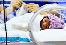 Premature Birth