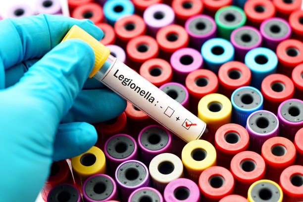 How do I test my water for Legionella