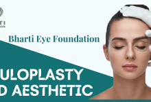 Ocuplasty Treatment - Featured Image