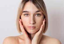 youthful looking skin